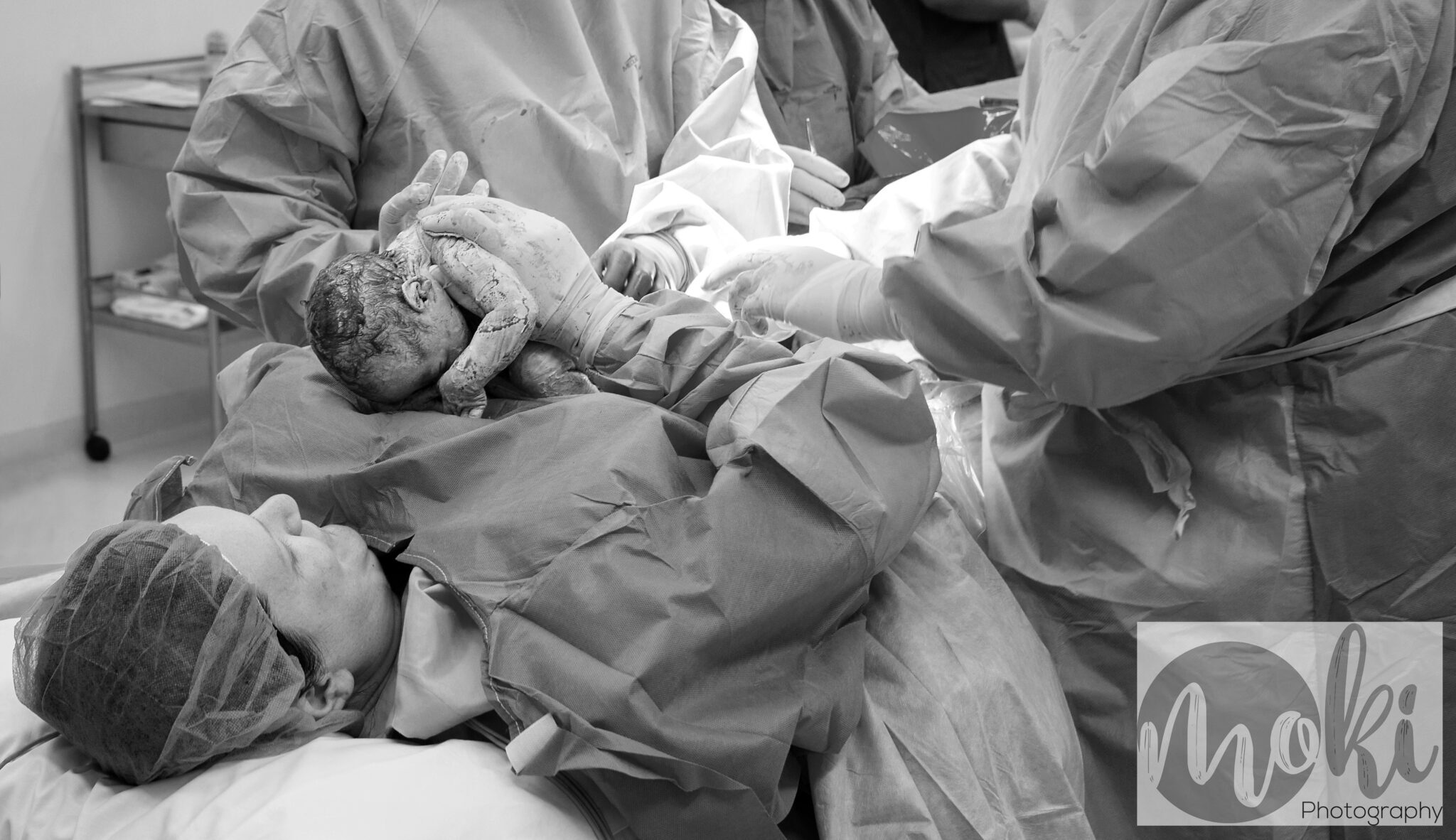 Maternal Assisted Caesarian Pardey And Associates